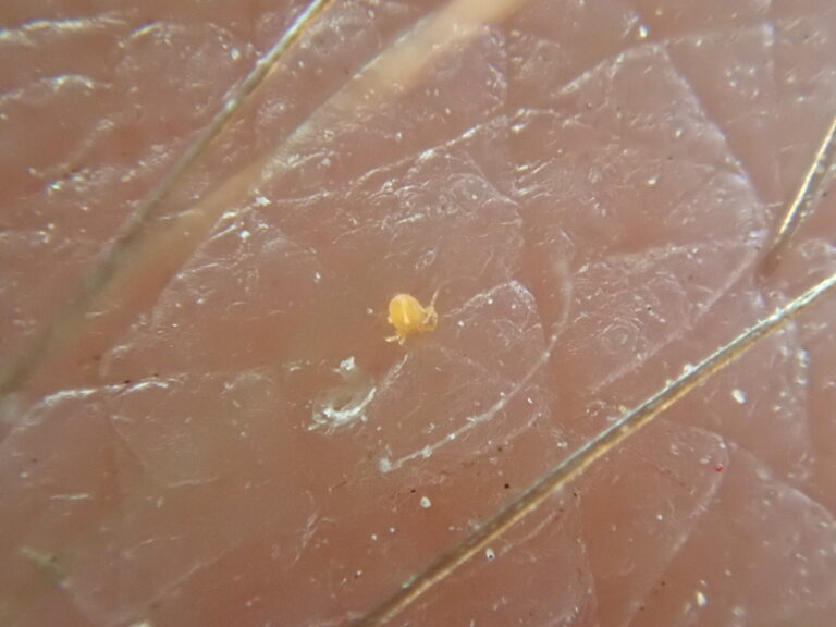 Tiny yellow-orange chigger larva crawling on human skin between hairs, seen through a macro lens